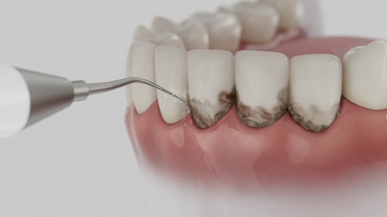 Reliable Tooth Extraction contractor in Powhatan County County, VA by Dentist Open Now